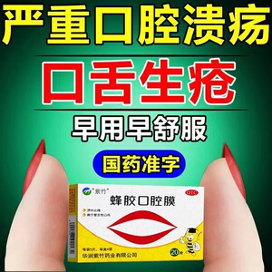 紫竹蜂胶口腔膜清热止痛口腔溃疡贴片复发性口疮气短止痛口舌生疮