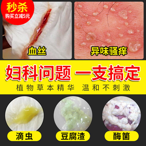 宫颈烂霉菌滴虫糜用药女性苦参凝胶阴炎私处护理正品保养抑菌排毒