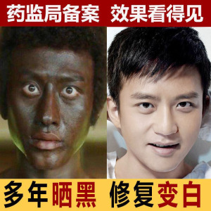 美白面膜男士专用控油补水增白夏天皮肤晒黑修复变白脸部专用修护