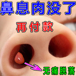 鼻息肉专用药鼻甲肥大治疗鼻塞鼻窦炎急慢鼻炎喷剂消炎修复一喷灵