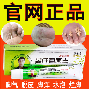 黄氏真菌王官网正品治疗严重脚气脚痒脱皮真菌感染水泡型药膏止痒