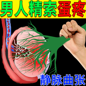 精索静脉曲张专用药精索炎睾丸痛药膏非治疗膏