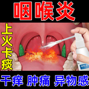 咽喉炎慢性咽炎异物感喷雾剂口腔溃疡喷剂咽干发炎喉咙肿痛咽炎贴