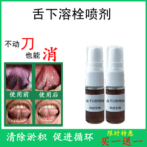 柯应舌下溶栓喷剂水蛭素提取物血管通畅淤积溶解血栓消除液一喷灵