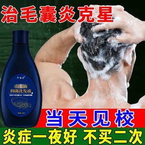 头皮毛囊炎洗发水治疗毛囊炎洗发水头痒头油有疙瘩头皮屑专用药膏