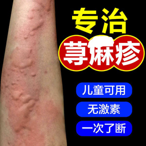 过敏胆碱能性荨麻疹过敏止痒断根专用药膏喷雾儿童泡澡中药克星寻