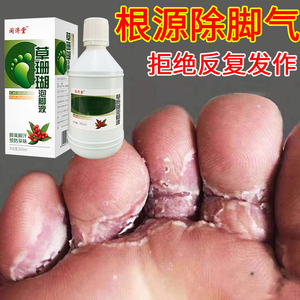 草珊瑚癣净泡脚液脚气泡脚一次净足癣真菌感染脚癣藓净癣痒药正品