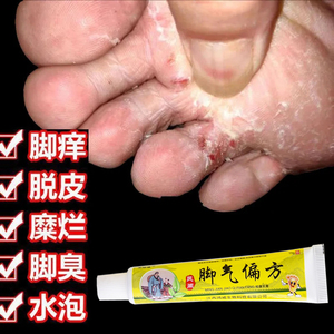 脚底痒止痒膏烂脚丫药脱皮糜烂脚趾缝烂痒脚丫子痒烂脚上起水泡痒