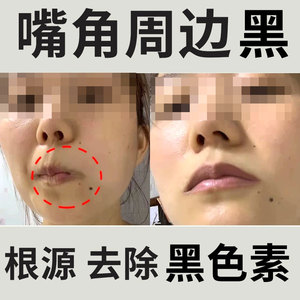 【去嘴唇周围黑色素】去嘴唇周围黑色素品牌,价格 - 阿里巴巴