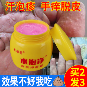 汗疱疹药膏汗孢疹克星汗泡疹膏汗状疱疹季节性手上起小水泡脱皮净