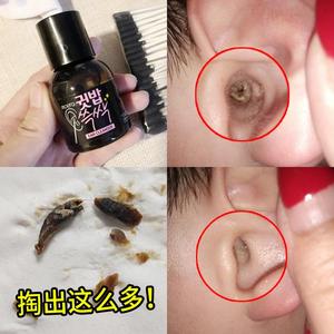 韩国成人软化液儿童掏耳神器耳屎掏成人抠扣挖耳勺挖耳朵采耳工.