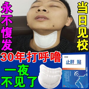 止鼾贴