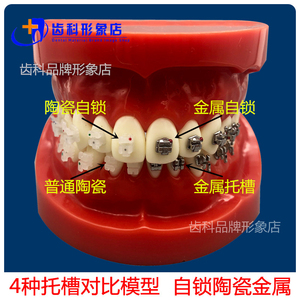 牙科口腔4种托槽对比模型 正畸陶瓷金属自锁托槽托槽示范模型包邮