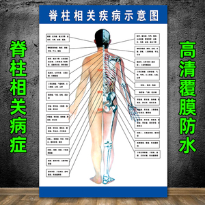 脊柱相关疾病示意图中医养生病理原因结构图挂图海报保健海报