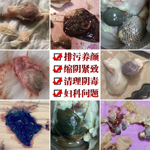 妇科清宫丸正品拉线子宫排毒清理女性私处凝胶紧致保养护理抑菌液