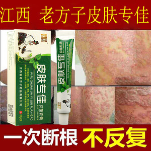 50成隆医疗器械专营店天猫39元4盒]藏药名家金癣克皮肤外用草本抑菌