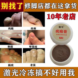 鸡眼药跖疣专用膏贴无痛去除血胞刺肉刺瘊子根断足部脚底老茧神器