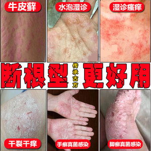 宛医湿毒康堂马肤夫舒爽软膏齐峰正品堂本肤膏芙乐草本肤抑菌乳膏