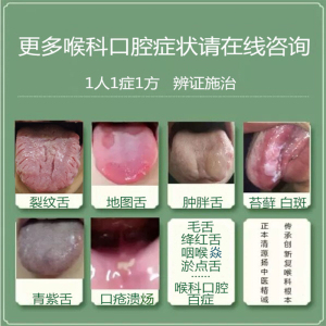 内服剂地图舌裂纹舌调理口藓舌藓舌头白斑舌苔厚黄白齿痕舌祛湿气