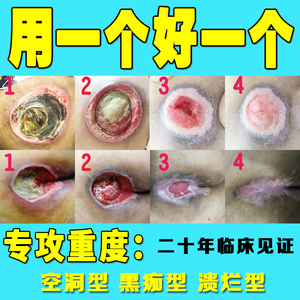 伤口修复生肌膏