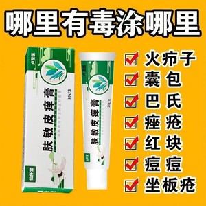 火疖子拔毒膏祛脓块坐板疮痘痘脓包痤疮祛毒屁股疮草本特效药膏