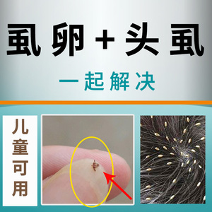 8075人付款淘宝虱子药儿童头虱子大人用去除阴虱跳蚤灭小女孩头发长的