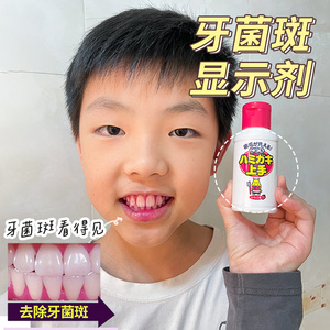 牙菌斑显示剂日本儿童口腔祛除显色去牙垢神器指示剂染色液体牙膏