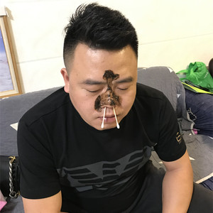 鹅不食草药膏油打喷嚏流鼻涕鼻塞流鼻水大人儿童专用包邮通气抑菌