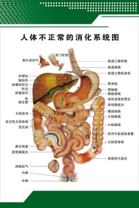 消化肠道系统结构示意图 医学宣传挂图 人体不正常消化系统海报