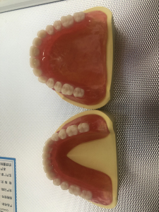 全口义齿标模展示模型,有新的吸附义齿模型,这个闲置