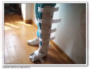 医用高分子支具胫腓骨膝部下肢外固定支具腿部踝骨骨折夹板石膏