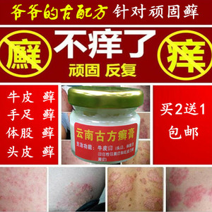 50 5人付款  淘宝 牛皮藓癣外用特效手足头体皮肤股藓膏大腿内侧痒灵