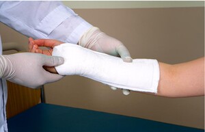 高分子石膏绷带