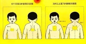 小儿咳嗽贴咳喘化痰宣肺贴婴幼儿清热儿童小孩平喘穴位贴清肺止咳