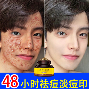 德国祛痘膏去痘印痘坑痘疤淡化痘印女男士学生非闭口粉刺修复神器