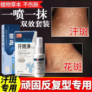 汗斑膏