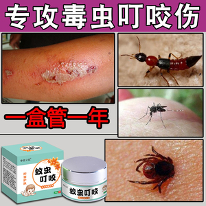 红蚂蚁咬伤药膏被蚊子叮的咬了隐翅虫治疗跳蚤虫子叮咬止痒消肿不