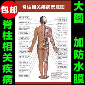人体脊柱挂图