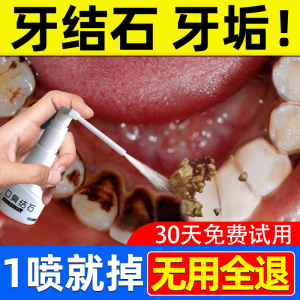 牙结石漱口水牙石去除剂黄牙垢牙齿溶解神器非速效去除器清除清洁