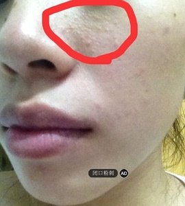 90llzzxiang淘宝泰国去黑头white芦荟胶正品猪鼻贴祛粉刺闭口白头