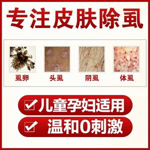 800人付款淘宝灭虱精小孩虱子药灭头虱阴虱体虱灭卵虮子去羽虱成人