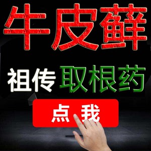 牛皮癣外用药中药老偏方牛皮癣膏药治牛皮鲜藓银屑皮肤治银屑癣药