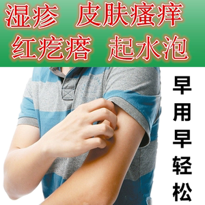苗药湿癣王皮肤瘙痒药膏治皮肤痒的药后背痒全身痒抑菌止痒消毒