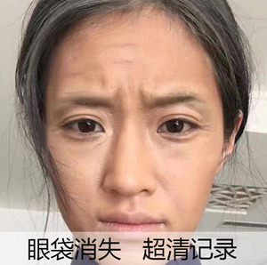 熬夜急救护肤品黄金眼膜淡化黑眼圈细纹去眼袋补水提拉紧致眼膜贴