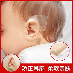婴儿耳廓矫正贴新生的儿耳朵宝宝防招风耳垂定型耳畸形纠正器