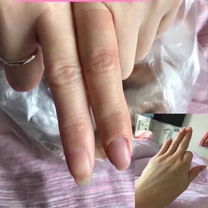 假手指伤残手指假手指套残疾人手指订做定制假手掌仿真手指断指