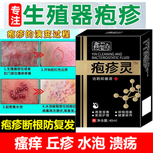 生殖男器疱疹根除防复发特效药私处瘙痒丘疹水泡溃疡疱疹断根克星