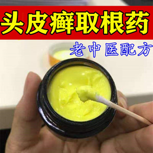 头皮癣专用药头癣药膏银屑癣头部真菌感染毛囊炎头皮屑头痒止痒膏