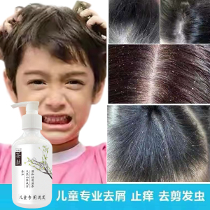 茶麸3-15岁洗发水儿童专用去头屑头痒去剪发虫卷发虫除螨洗发水露
