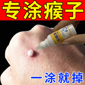 去猴子肉粒疙瘩丝状疣扁平尤脖子小肉粒祛疣瘊药膏肉赘瘊子药神器
